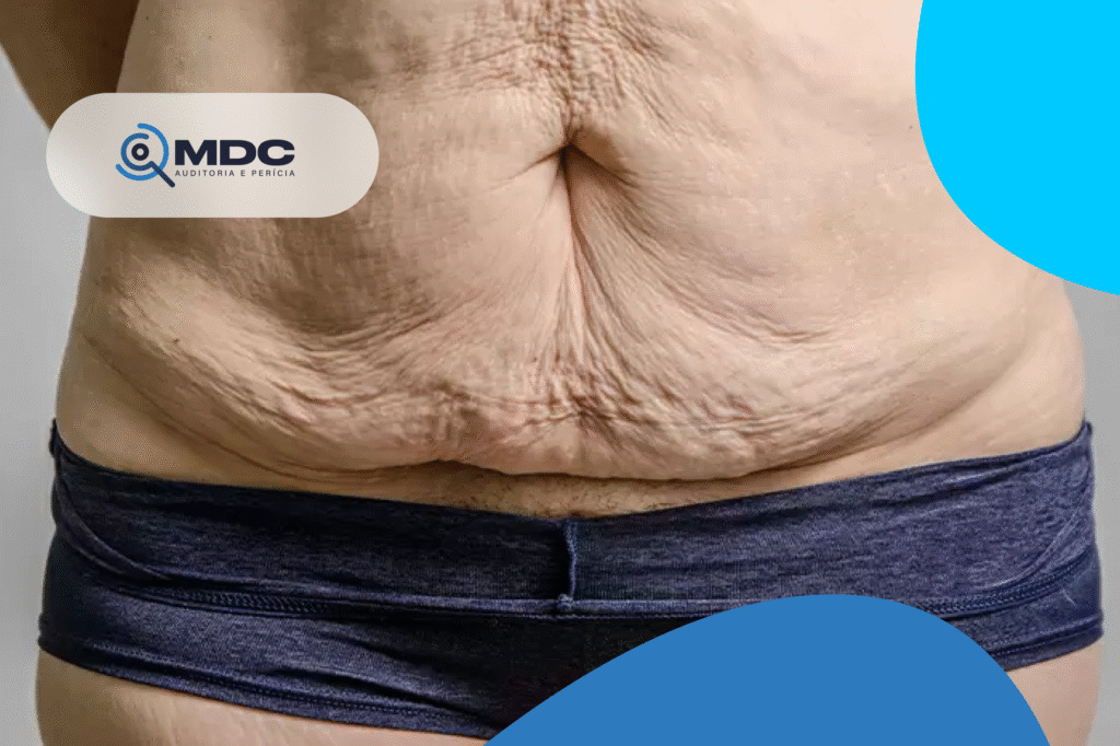 alt="perícia médica_pós-bariátrica"